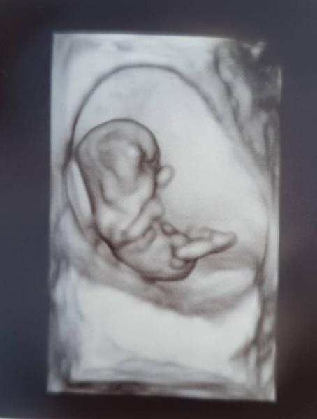 Bild zu Geschlecht 3D Ultraschallbild - Forum für April - Mamis