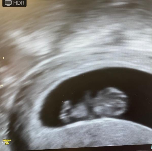Bild zu Geschlecht? :) - Forum für April - Mamis