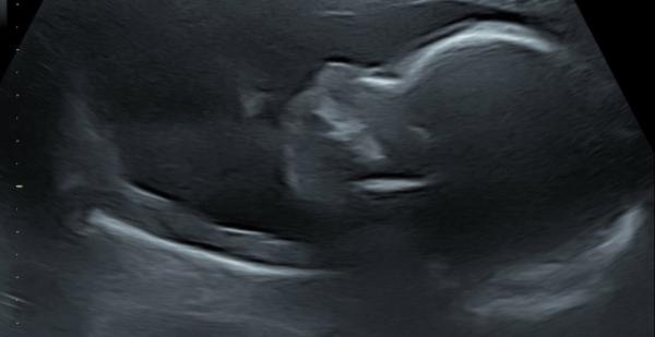 Bild zu Skull Theorie - Forum für April - Mamis