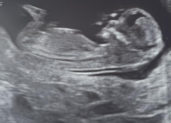 Bild zu Was denkt ihr was es wird? 12+3 - Forum für April - Mamis