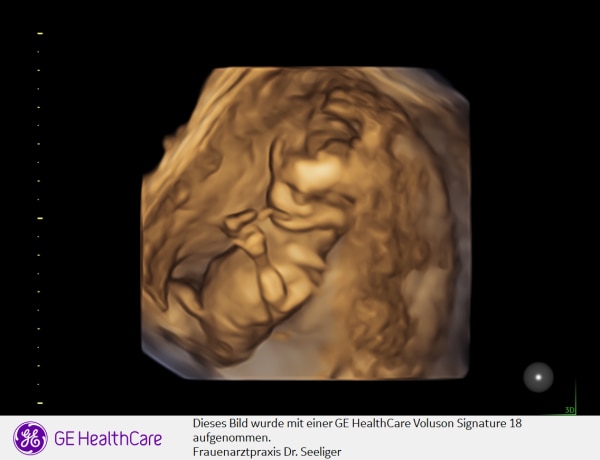 Bild zu 1 Trimester größer Ultraschall und Nipttest - Forum für April - Mamis