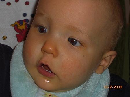 Bild zu 