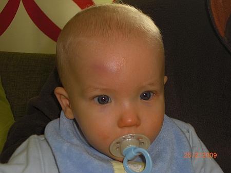 Bild zu
