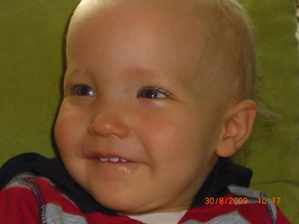 Bild zu