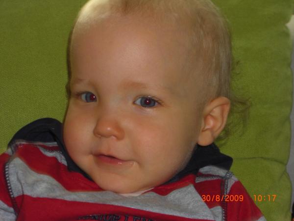 Bild zu