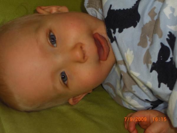 Bild zu