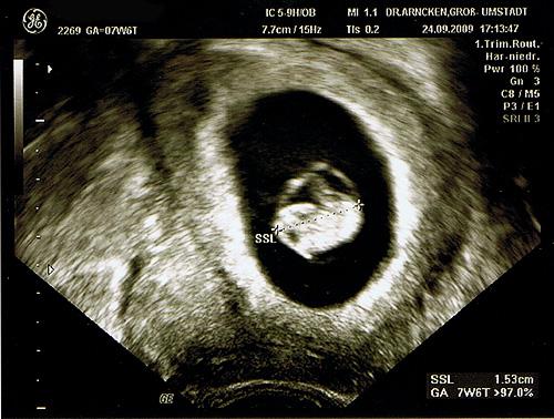Bild zu Ich bin auch dabei!!!!! - Forum für Mai - Mamis