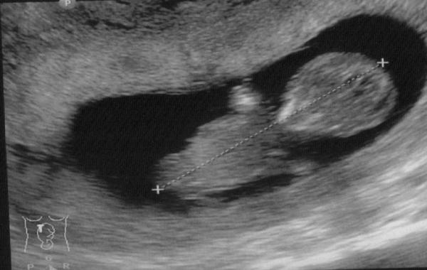 Bild zu Hier das versprochene Bild - Forum für Mai - Mamis