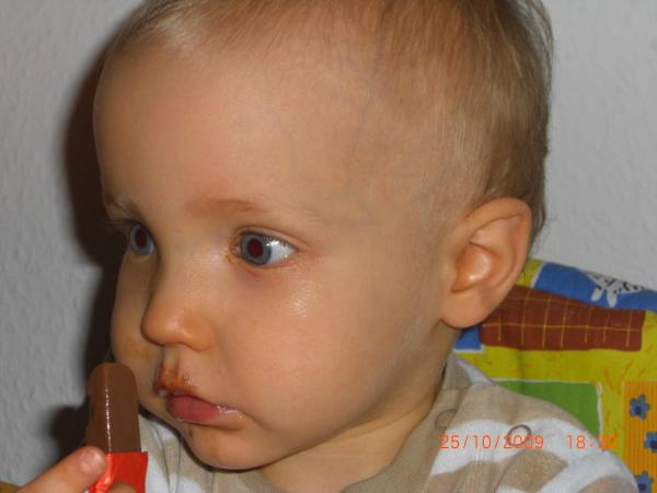 Bild zu