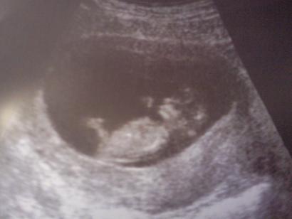Bild zu Neues Foto:-) - Forum für Mai - Mamis