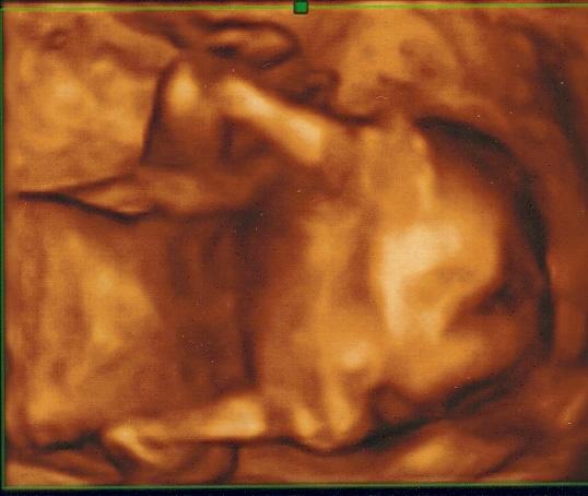 Bild zu Habe mehr oder weniger leider schlechte 4D Bilder ... - Forum für Mai - Mamis