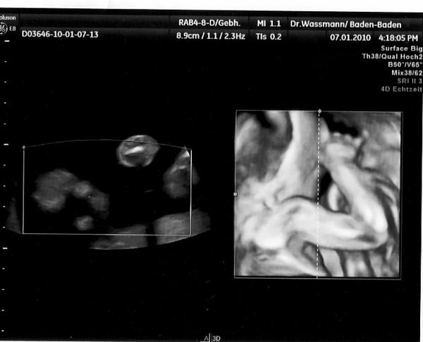 Bild zu 2 Bilder von heute ... - Forum für Mai - Mamis