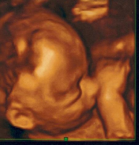 Bild zu 4D heute, hab ein paar Bilder wer schauen möchte ... - Forum für Mai - Mamis