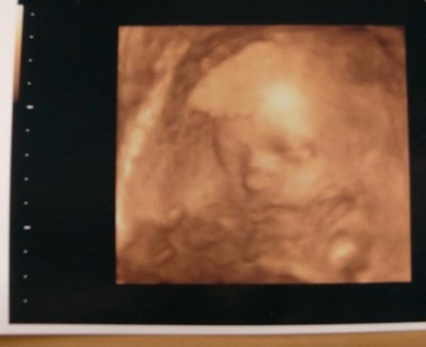 Bild zu 3D bilder - Forum für Mai - Mamis
