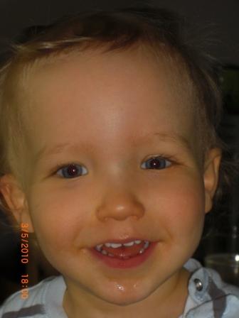 Bild zu 