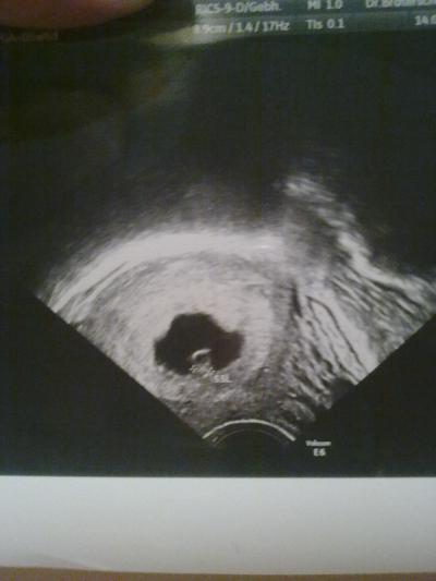 Bild zu Werde auch ne Mai 2011 Mami :-) - Forum für Mai - Mamis