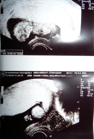 Bild zu Heut nun endlich beim Gyn und 2 Bildchen - Forum für Mai - Mamis