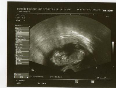 Bild zu Bild von meinem Würmchen :-D - Forum für Mai - Mamis