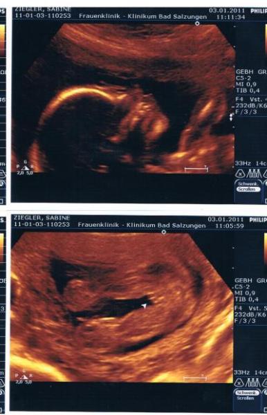 Bild zu Zurück von FD - Forum für Mai - Mamis