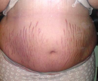 Bild zu babybauch - Forum für Mai - Mamis