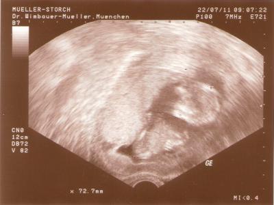 Bild zu Zurück von der VU =) - Forum für Mai - Mamis