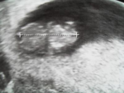 Bild zu FA-Bericht - Forum für Mai - Mamis