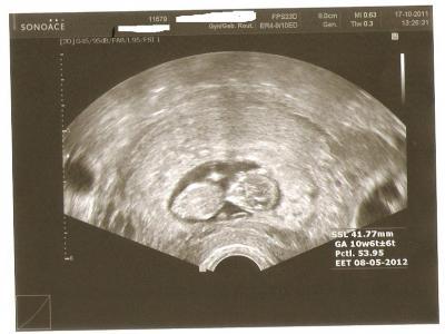 Bild zu auch ich war heut beim arzt - Forum für Mai - Mamis