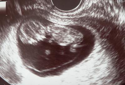 Bild zu Schön, dass es jetzt so viele positive Neuigkeiten gibt.... :) freu :) - Forum für Mai - Mamis