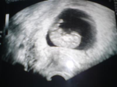 Bild zu Huhu ;) - Forum für Mai - Mamis