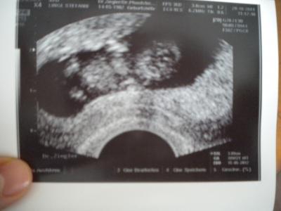 Bild zu Baby TV Bild - Forum für Mai - Mamis