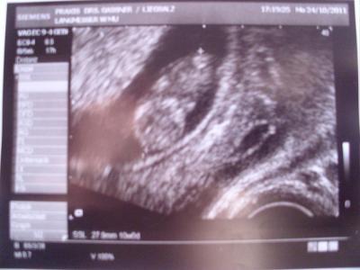 Bild zu So war ja nun gestern bei FA..................... - Forum für Mai - Mamis