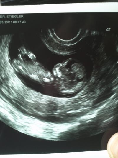 Bild zu War heute ausserplanmässig beim Frauenarzt... - Forum für Mai - Mamis