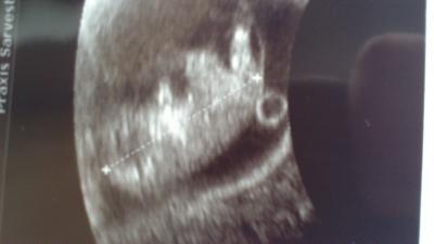 Bild zu der Hammer! - Forum für Mai - Mamis