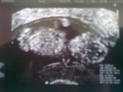 Bild zu 3.te Ultraschall und alles Bestens =) - Forum für Mai - Mamis