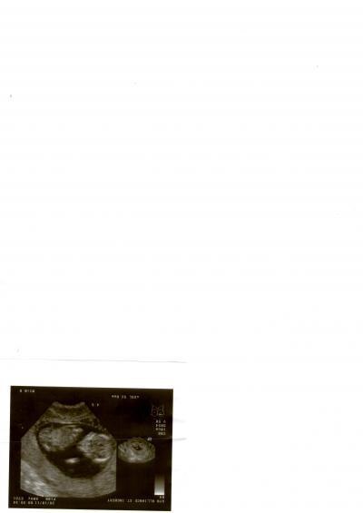 Bild zu Screenig beim Fa und Nackenfalte - Forum für Mai - Mamis