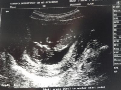 Bild zu Züruck vom FA - mit Bild :-)! - Forum für Mai - Mamis