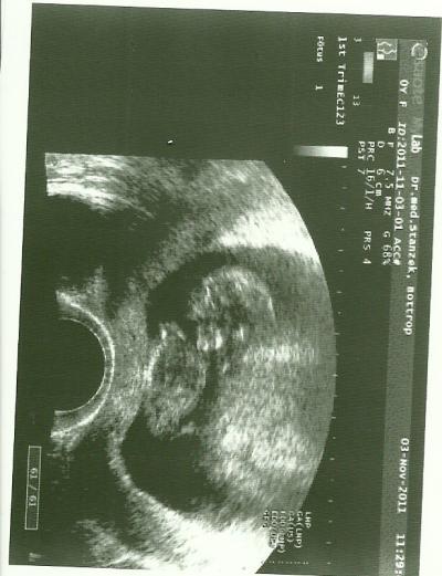 Bild zu Die überglücklichste Mami meldet sich :) - Forum für Mai - Mamis