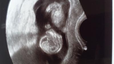 Bild zu wieder daaaaaa mit Bildchen :-D - Forum für Mai - Mamis