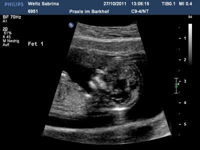 Bild zu Bilder von meinen Krümeln! - Forum für Mai - Mamis