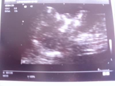 Bild zu Gestern VU und....... - Forum für Mai - Mamis