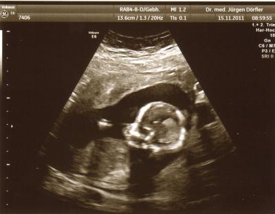 Bild zu Neues Bild vom Krümelchen :-) - Forum für Mai - Mamis