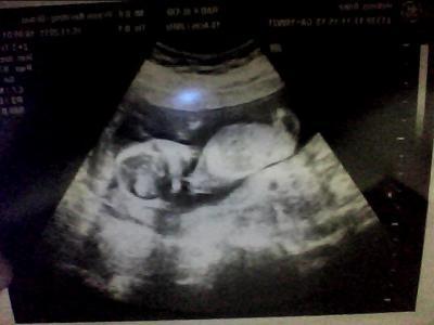 Bild zu Bericht vom FA-Termin gestern - Forum für Mai - Mamis