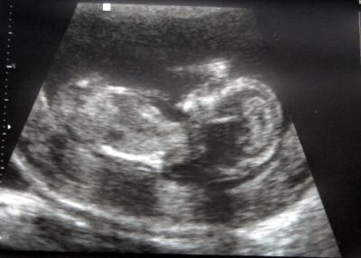 Bild zu Das Bild von der NFM-Messung - Forum für Mai - Mamis