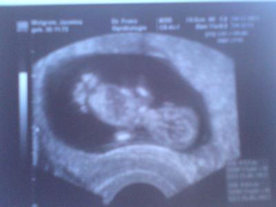 Bild zu Bild vom letzten US - Forum für Mai - Mamis