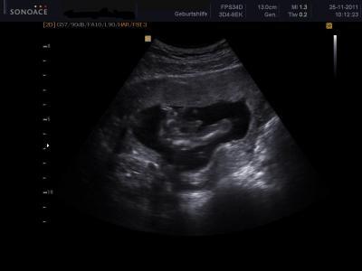 Bild zu Sicher ein Junge ? - Forum für Mai - Mamis