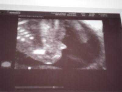 Bild zu Bilder - Forum für Mai - Mamis