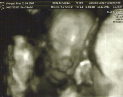 Bild zu Bilder feindiagnostik - Forum für Mai - Mamis