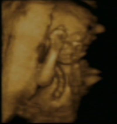 Bild zu 3D Bild von unserem Krümel :-) - Forum für Mai - Mamis