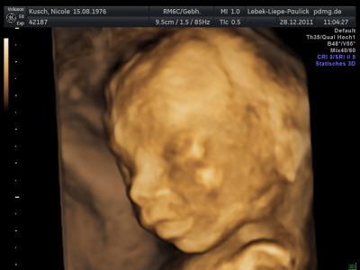 Bild zu Outing - Forum für Mai - Mamis