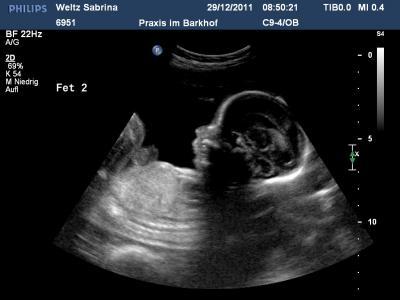 Bild zu Bilder - Forum für Mai - Mamis